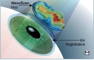sarinascotti's tweet photo. LASIK to see better without Repulsive Glasses and Lenses :  http://t.co/rfhFqjC3Lp http://t.co/FdTtpuvbzE