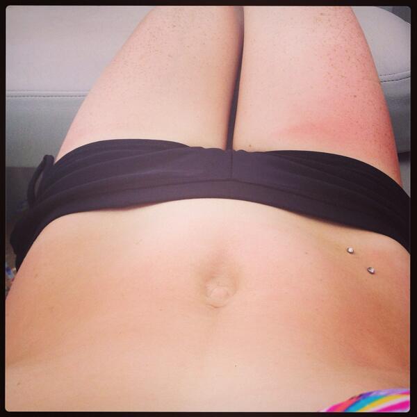 trystan1991's tweet photo. Can you feel the burn? http://t.co/wCpfZs0RgC