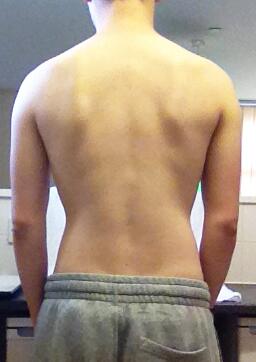 SamMathew20's tweet image. Pre-Steroid/Workout/Diet - Back