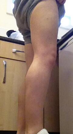 SamMathew20's tweet image. Pre-Steroid/Workout/Diet - Legs Side