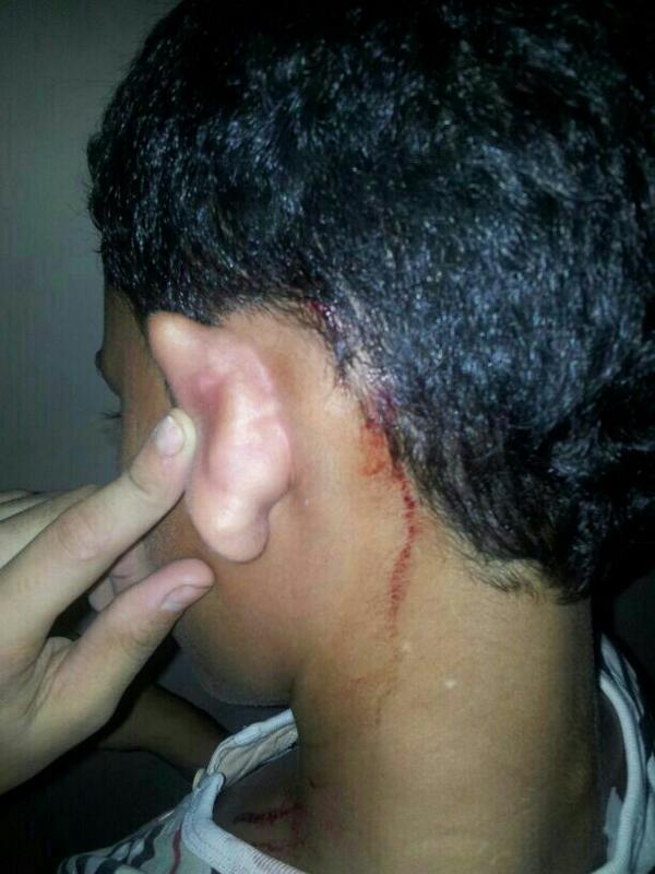 RT <a href="/SAIDYOUSIF/">Sayed Yusuf Almuhafdha</a>: #bahrain 15 years old shotgun injury in sitra yesterday