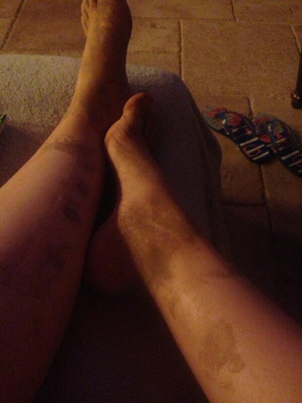 Caitlin Beadles On Twitter I Think My Feet Are Permanently Stained Lol Http T Co Ti1cxycxkn Twitter