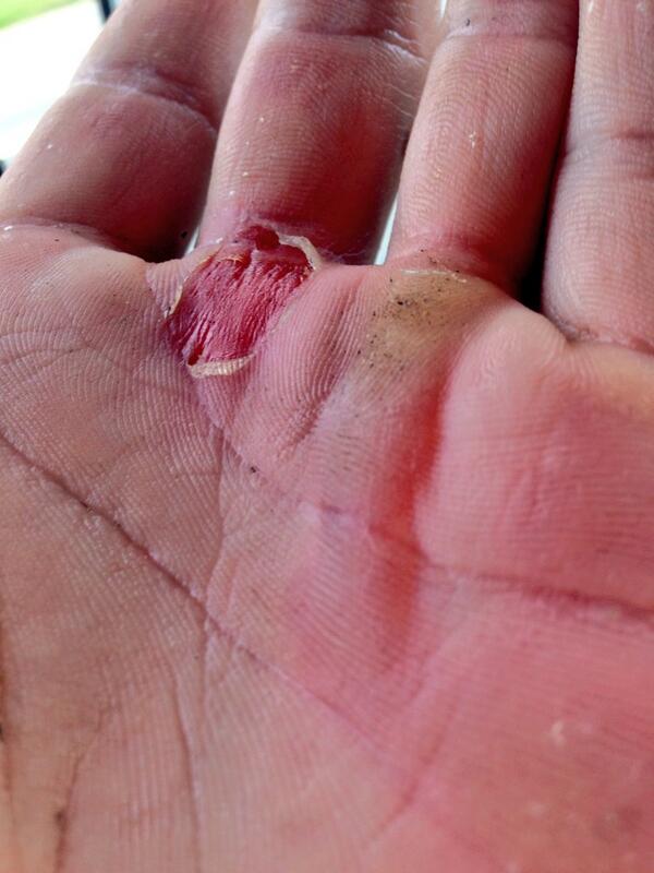 Love going to work with a hand like this #not