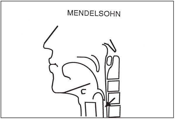 Understand Dysphagia tweet media