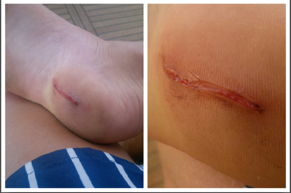thrcherry's tweet image. Sorry for the horrible feet! But life's a bitch! :( #FML