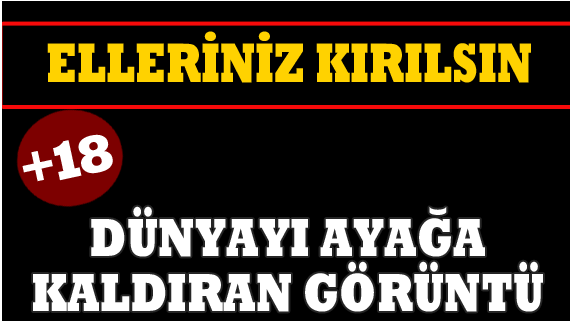 Manşete bakın dünyayı ayağa kaldıran mesele şu ABD'de bir veteriner köpeğe kötü davranmış. Mısır ve Suriye'ye tık yok