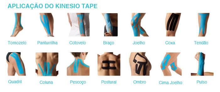 Тейпирование воротниковая зона. Кинезио тейп на коленный сустав. Кинезио тейп на плечевой сустав. Как правильно клеить тейп. Кинезио тейп 2,5 см.