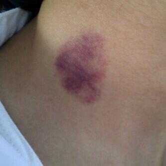 hac.boy.Dmar Alharbi (@apood222111) on Twitter photo 