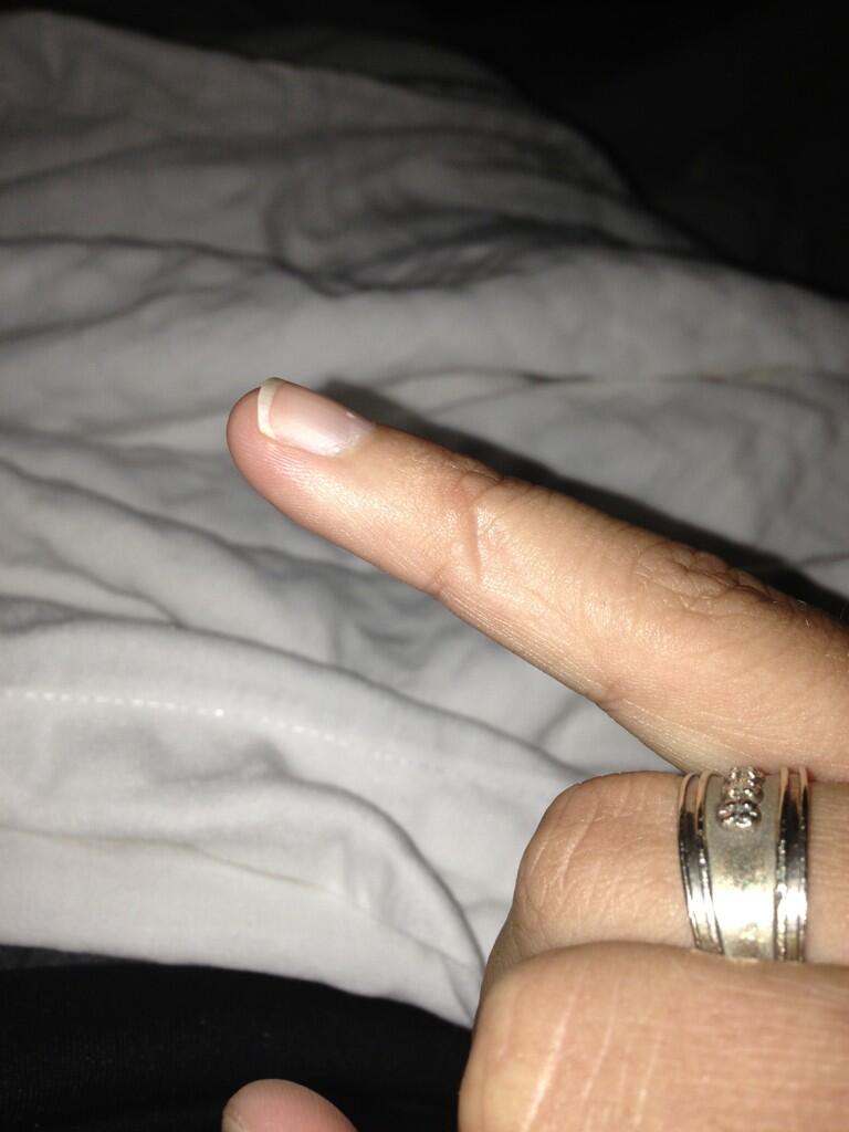 Abby Wambach on X I think my iphone is used way too much. Mine leaves an indent on my pinky from using it. embarrassingtweet http t 9YrzEJ2U4w X