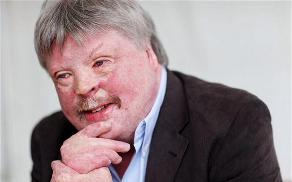 HoylakeRNLI's tweet photo. We're pleased to welcome inspirational @Simon_Weston to @HoylakeRNLI Open Day 2013, supporting @InvisInjuries stall. http://t.co/6TQ6xsqicZ