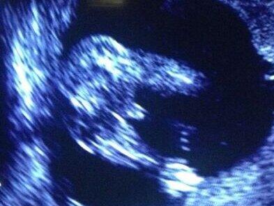 davidgamez19's tweet photo. Hugo a la vista....!!!!:-):-):-):-) http://t.co/T1Qkytgww5