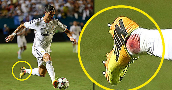 RMadridSoccer's tweet photo. Cristiano terminó el partido contra el Chelsea con el tobillo ensangrentado. (via @primillo7) http://t.co/jy1yMzsjad