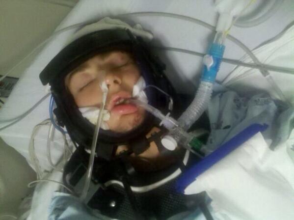 and this was the day after the accident.. #p