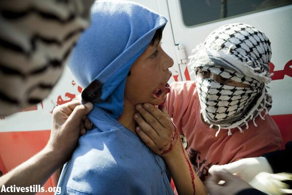 TrueWorldOrder2's tweet photo. #Israel-i military shoots 14-year-old protester in face with rubber bullet. #Palestine #Gaza http://t.co/8NrJntyv8x http://t.co/Jxt7PmORBM