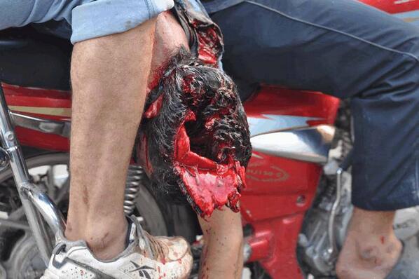 romomangoen's tweet photo. @BarackObama RT @gelhaddad: How blood thirsty can they be !! Horrific photo of protestor shot in head. http://t.co/dzD2Z59tJB