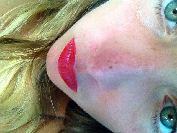 ChloMh's tweet photo. Les tâches de rousseur ☀☀☀☀☀☀☀ http://t.co/1bCU1IPzgn