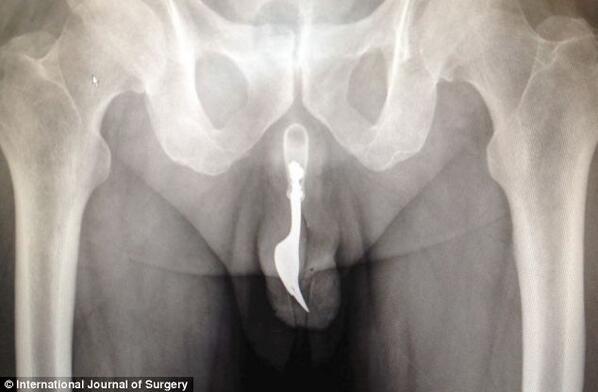 Image result for gun up butt xray