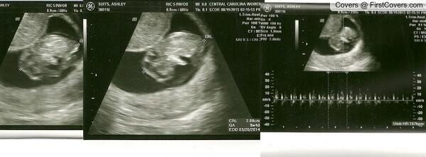 asuits's tweet photo. #BabyClapp #MyLife #MyLove #DueMarch202014 http://t.co/Uj204GNfNC