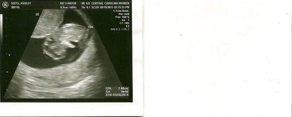 asuits's tweet photo. 9 weeks and 4 days!! #ILoveMyBaby #BabyClapp http://t.co/5TLUN9wZTL