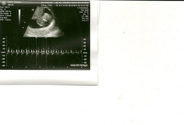 asuits's tweet photo. #ILoveYou #MyBaby http://t.co/saHSY3LXqP