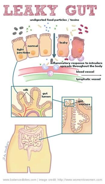 ACoPinckney's tweet image. Preview of our "What is your Gut telling You?" #Seminar. Tmrw at the #Pinckney Library @ 6:15 #veterinary #vetmed