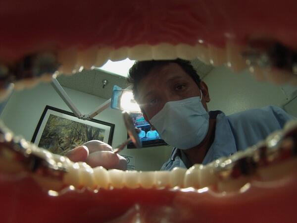 GoPro's tweet photo. Photo of the Day! Open up and say "ahhhh." Angel Vera shares a unique view of a trip to the dentist. #GoPro #Teeth http://t.co/MGUvKbMIxx