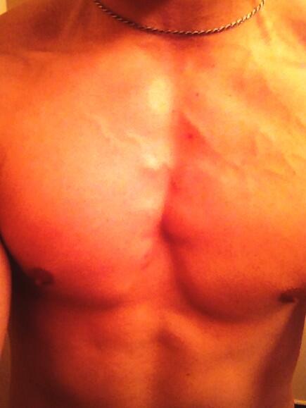 ThatFitCouple's tweet image. Chest vasculature! #post #workout #favorite