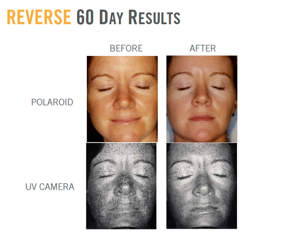 RF_ErinMonaghan's tweet photo. REVERSE the summer! Incidental sun exposure adds up - learn about undoing the damage. http://t.co/jI9uAT3kl6 http://t.co/Wf4nOKAB2R