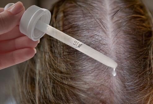 The market is flooded with so-called hair growth products, but Groei360 is the proven remedy for hair loss.
