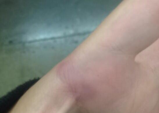 vxnxcebxtch's tweet image. so much pain omg #colorguardproblems