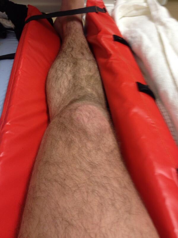 D7Nicky's tweet image. 5months since my knee decided to destroy itself, 5 weeks and counting and I am back!! 

 #LeftFootWand