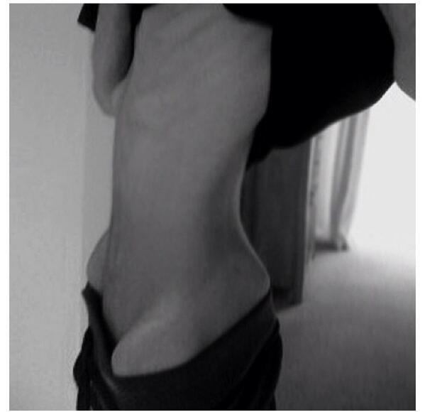 "@skinnyanorexic: Cause I bones #thinspo #bonespo #hipbones #skinny #a...