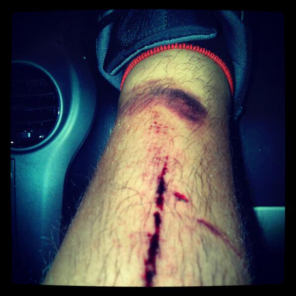 PapperCutzz's tweet image. Just a paper cuts.. #Boom