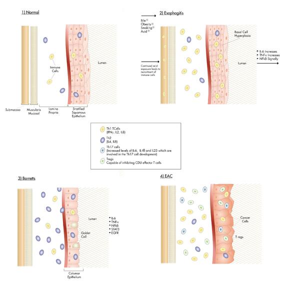 We were asked to illustrate the development of EAC <a href="/hanloco/">Ciara O'Hanlon</a> Congrats on first publication: authors.elsevier.com/sd/article/S03…