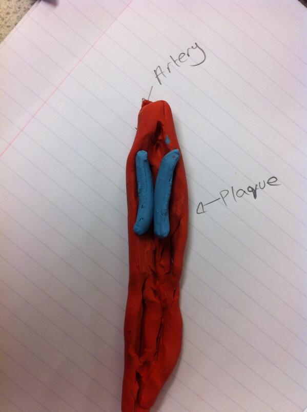 TCOLCScience's tweet photo. Doha's artery model http://t.co/L78lE5Ji6U