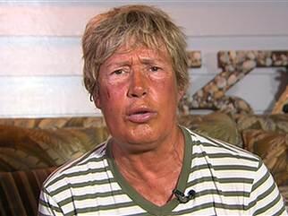 eparry's tweet image. If Harpo Marx had a love child with an old saddle...Diana Nyad