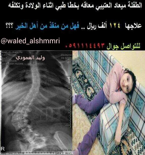 WaleedAlshmmari's tweet photo. الطفله #ميعاد_العتيبي تنشدكم ايصال صوتها فقط ماتطلبه علاج لاتبخل عليها برتويت
فيديو:
  https://t.co/uZOo4CMCcs
صوره: http://t.co/6ZyHpvfV7U