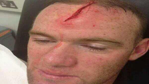 FcEcuador's tweet photo. Imagenes de Rooney y lo que dejo su terrible choque...b http://t.co/qjYNj3q0Dp