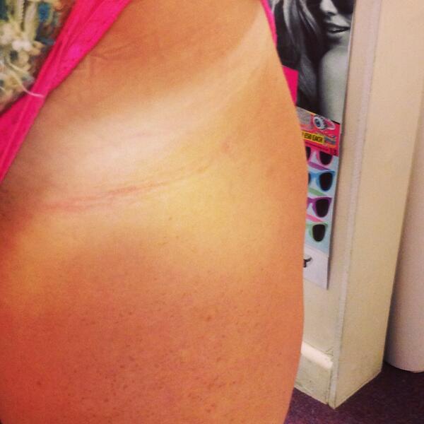 Tanningtemple's tweet photo. Colour of client after guide tan washed off #happycustomer perfect glow http://t.co/hqsHyCJMja