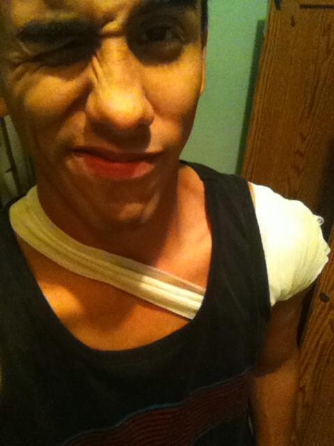 morari_jp's tweet photo. My arm is pretty banged up :/ it's in pain !! http://t.co/2pGPbtuxEc