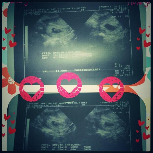 Eymzz's tweet photo. hi baby! see u after 33 weeks! http://t.co/PEKbVrDC5m