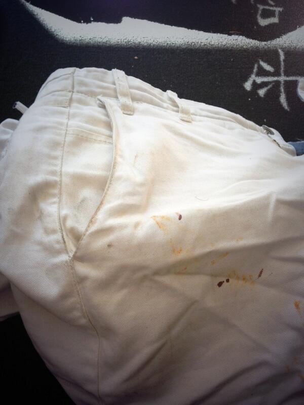 einarfessy's tweet image. Hade vita byxor en gång i tiden. Blod och korvrester? #fest #igår