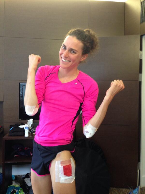 gwenjorgensen's tweet photo. Bandaged and bruised but can still smile.  #2014 http://t.co/tbdfFtfkpq