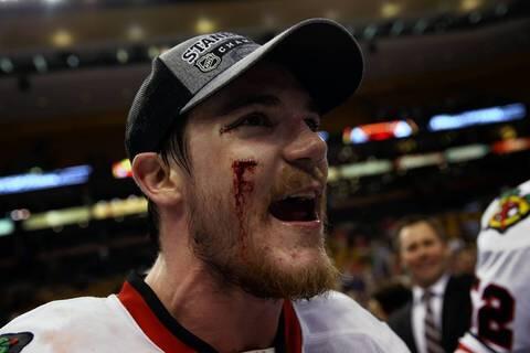 broomem's tweet image. #Puckface #AndyShaw hit in face last game-6th-of Stanley Cup finals. Plays w/stiches in cheek &amp;amp; corner of eye.