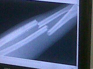 <a href="/sebitaordonez/">Sebastian Ordoñez</a> yesito para rato