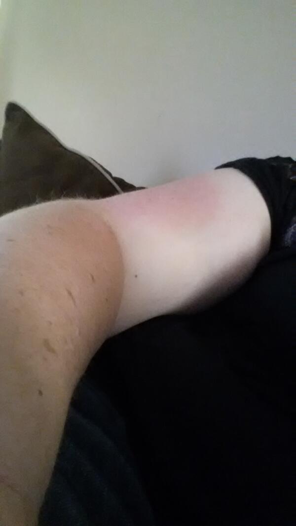 megsmakesmusic's tweet image. My awkward multi-colored arm -__- #thankstennis