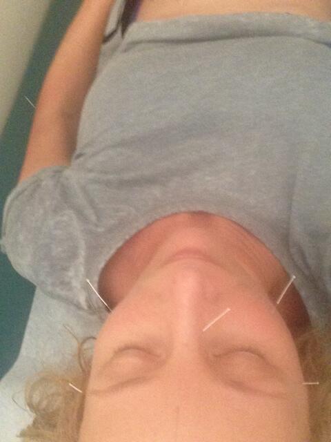 ColorYourWay's tweet image. #serenitysaturday blissing out with facial acupuncture at Tao of Wellness.