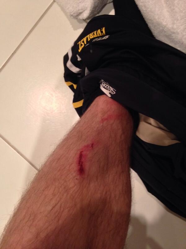 roddjbrown's tweet image. Kids shinpands. #ineffectual