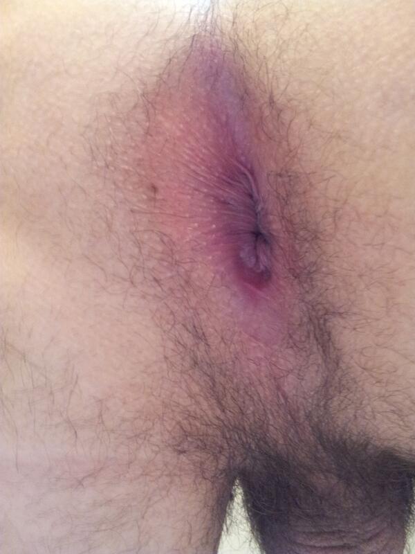 kylebbgay's tweet photo. “@parrtyboy: Got loaded by my bf so loose haha;) http://t.co/IJk8tDKwKM” beautiful ass!