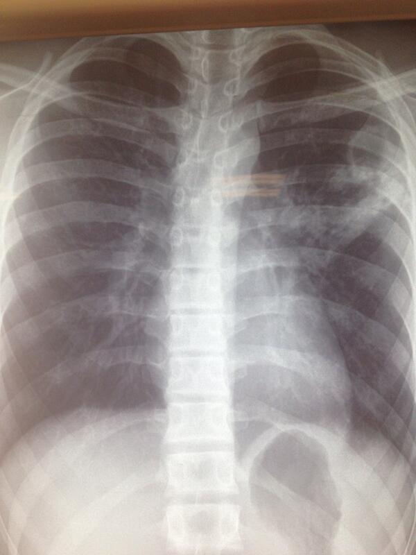 niflugel's tweet photo. Je tousse donc je sue http://t.co/NC2SJOQKpE